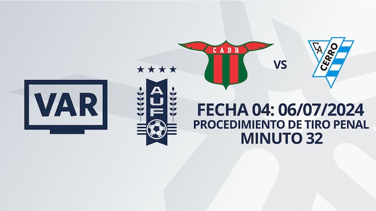 Intermedio Fecha 4 | Boston River vs Cerro ('32)